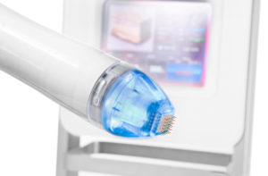 Your Vivace RF Microneedling Treatment