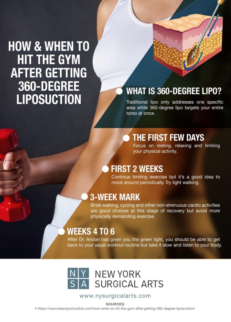 How & When to Hit the Gym after Getting 360Degree Liposuction