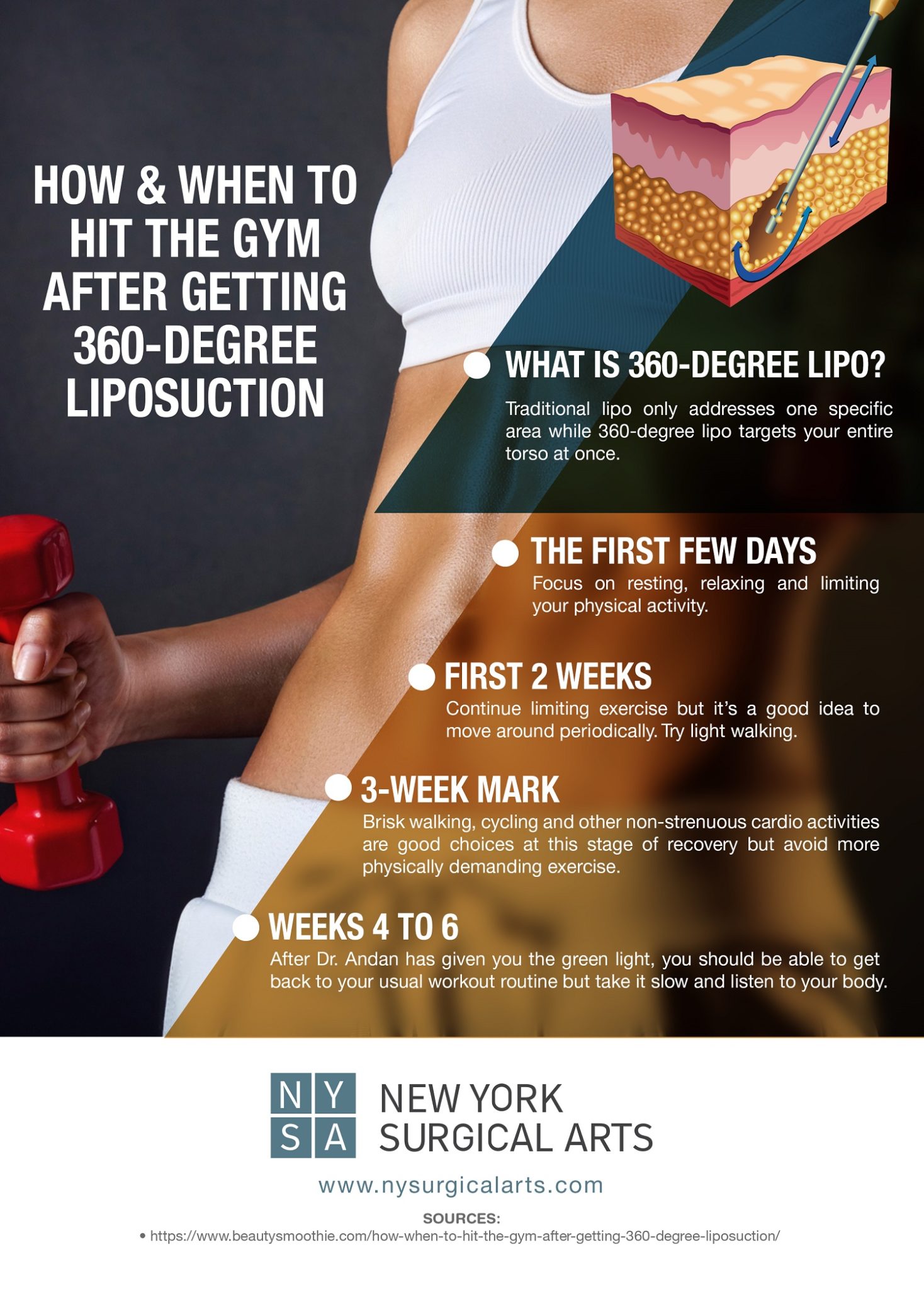 How & When to Hit the Gym after Getting 360Degree Liposuction