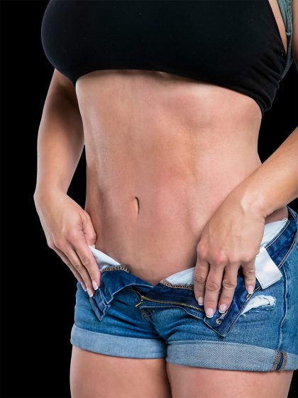 Abdominal Etching Before & After Patient #2396