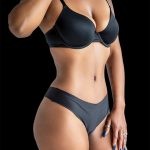 Tummy Tuck Before & After Patient #2687