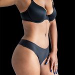 Tummy Tuck Before & After Patient #2687