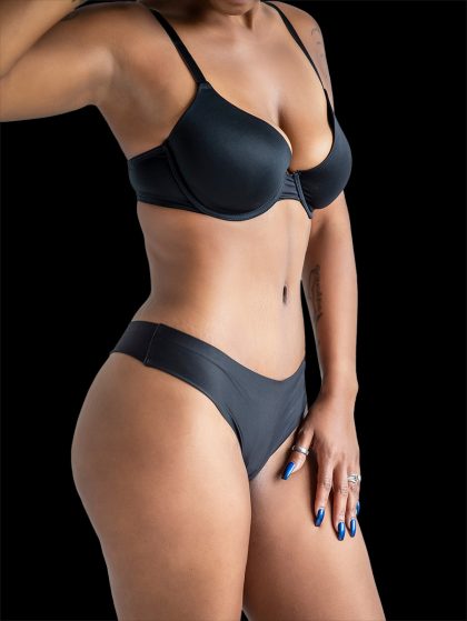 Tummy Tuck Before & After Patient #2687